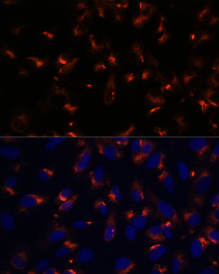Immunofluorescence analysis of U-2 OS cells using CCDC47 Polyclonal Antibody at dilution of  1:100. Blue: DAPI for nuclear staining.