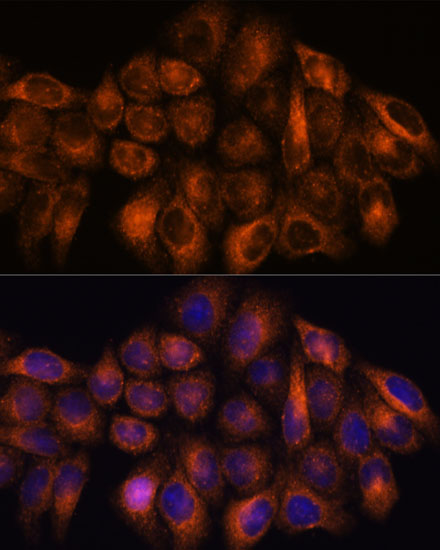 Immunofluorescence analysis of HeLa cells using MMP25 Polyclonal Antibody at dilution of  1:100. Blue: DAPI for nuclear staining.