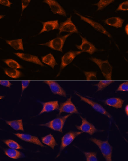 Immunofluorescence analysis of L929 cells using MMP25 Polyclonal Antibody at dilution of  1:100. Blue: DAPI for nuclear staining.