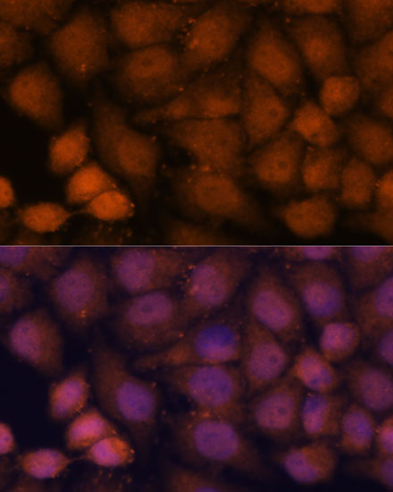 Immunofluorescence analysis of HeLa cells using CEP85 Polyclonal Antibody at dilution of  1:100. Blue: DAPI for nuclear staining.