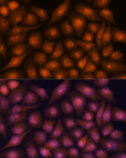 Immunofluorescence analysis of HeLa cells using DDX31 Polyclonal Antibody at dilution of  1:100. Blue: DAPI for nuclear staining.