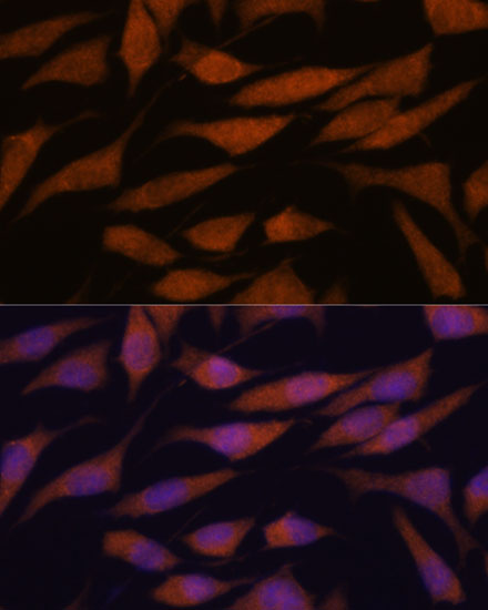 Immunofluorescence analysis of L929 cells using DDX31 Polyclonal Antibody at dilution of  1:100. Blue: DAPI for nuclear staining.