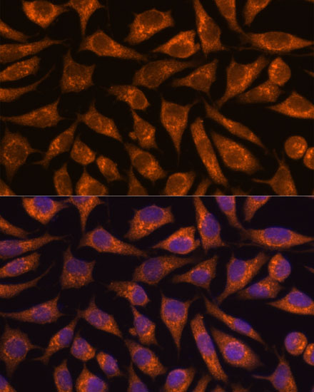 Immunofluorescence analysis of L929 cells using B3GNT4 Polyclonal Antibody at dilution of  1:100. Blue: DAPI for nuclear staining.