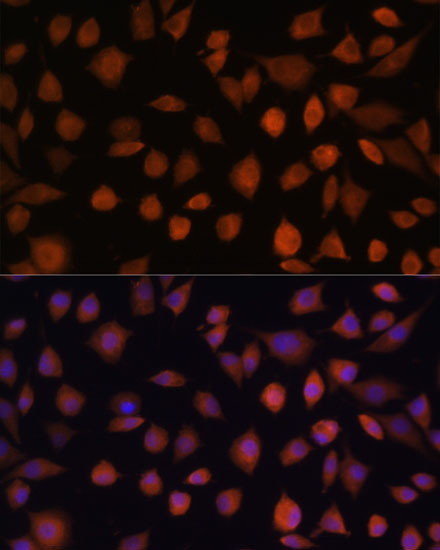 Immunofluorescence analysis of L929 cells using ARMC6 Polyclonal Antibody at dilution of  1:100. Blue: DAPI for nuclear staining.