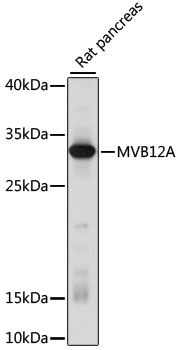 Western blot analysis of extracts of Rat pancreas using MVB12A Polyclonal Antibody at dilution of 1:1000.