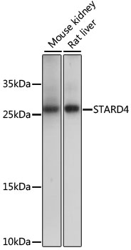 Western blot analysis of extracts of various cell lines using STARD4 Polyclonal Antibody at dilution of 1:1000.