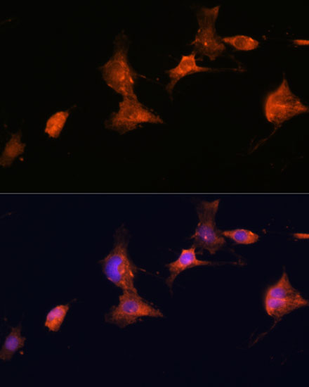 Immunofluorescence analysis of C6 cells using TSC2 Polyclonal Antibody at dilution of  1:100. Blue: DAPI for nuclear staining.