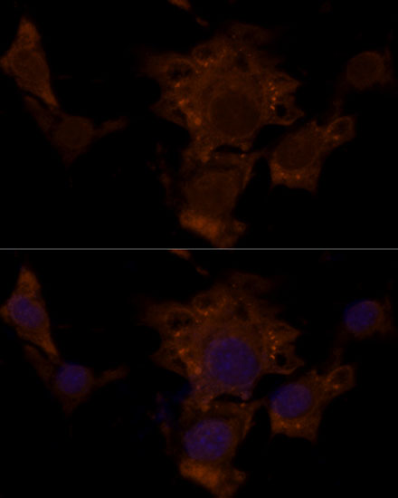 Immunofluorescence analysis of NIH/3T3 cells using TSC2 Polyclonal Antibody at dilution of  1:100. Blue: DAPI for nuclear staining.