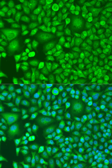 Immunofluorescence analysis of U2OS cells using RARB Polyclonal Antibody at dilution of  1:100. Blue: DAPI for nuclear staining.