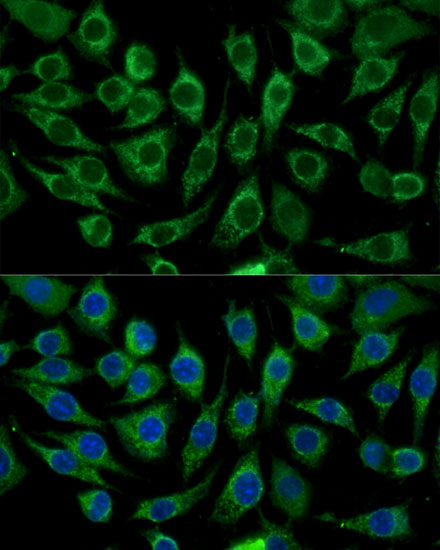 Immunofluorescence analysis of L929 cells using ABCD2 Polyclonal Antibody at dilution of  1:100 (40x lens). Blue: DAPI for nuclear staining.