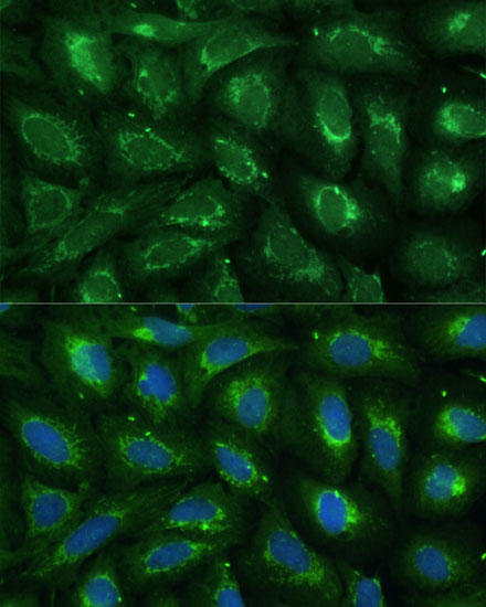 Immunofluorescence analysis of U-2 OS cells using ABCD2 Polyclonal Antibody at dilution of  1:100 (40x lens). Blue: DAPI for nuclear staining.