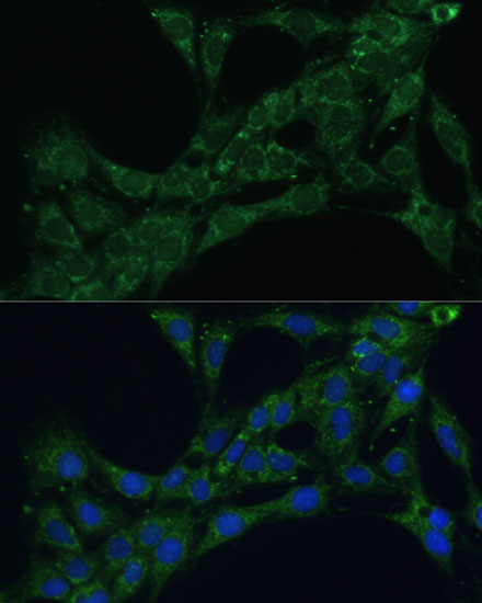 Immunofluorescence analysis of C6 cells using ETFB Polyclonal Antibody at dilution of  1:100 (40x lens). Blue: DAPI for nuclear staining.