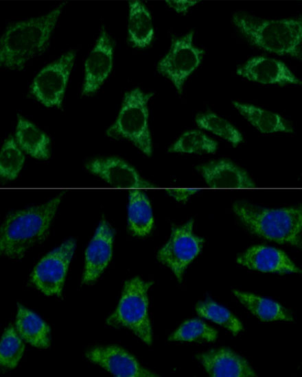 Immunofluorescence analysis of L929 cells using ETFB Polyclonal Antibody at dilution of  1:100 (40x lens). Blue: DAPI for nuclear staining.