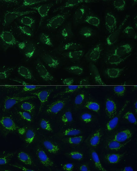 Immunofluorescence analysis of U-2 OS cells using ETFB Polyclonal Antibody at dilution of  1:100 (40x lens). Blue: DAPI for nuclear staining.