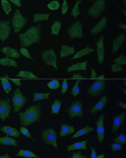 Immunofluorescence analysis of L929 cells using PTK2B Polyclonal Antibody at dilution of  1:100. Blue: DAPI for nuclear staining.