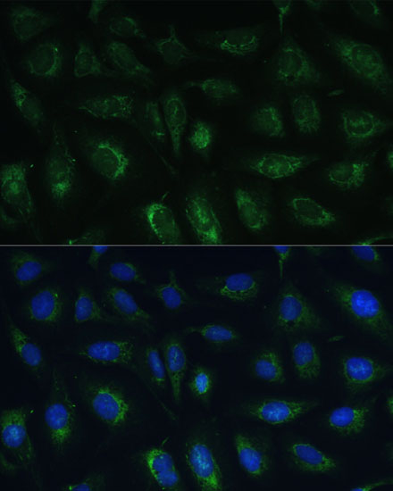 Immunofluorescence analysis of U-2 OS cells using RAPGEF1 Polyclonal Antibody at dilution of  1:100 (40x lens). Blue: DAPI for nuclear staining.