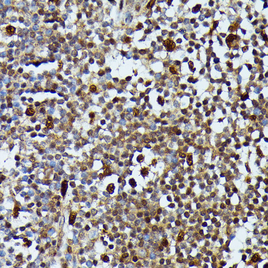 Immunohistochemistry of paraffin-embedded Human appendix using MAP3K3 Polyclonal Antibody at dilution of  1:100 (40x lens).