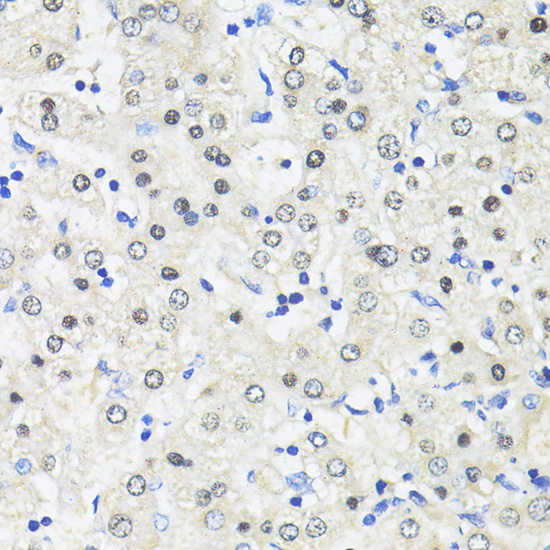 Immunohistochemistry of paraffin-embedded Human liver using TRIM27 Polyclonal Antibody at dilution of  1:100 (40x lens).