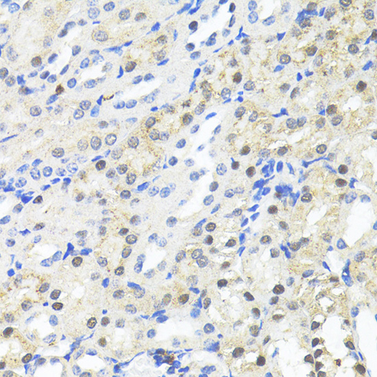 Immunohistochemistry of paraffin-embedded Mouse kidney using TRIM27 Polyclonal Antibody at dilution of  1:100 (40x lens).