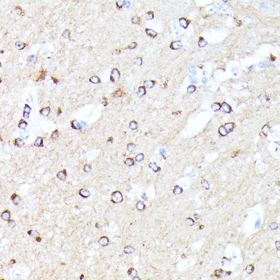 Immunohistochemistry of paraffin-embedded Mouse brain using CCDC6 Polyclonal Antibody at dilution of  1:100 (40x lens).