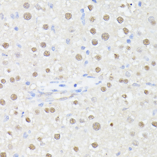 Immunohistochemistry of paraffin-embedded Rat liver using MLF2 Polyclonal Antibody at dilution of  1:100 (40x lens).