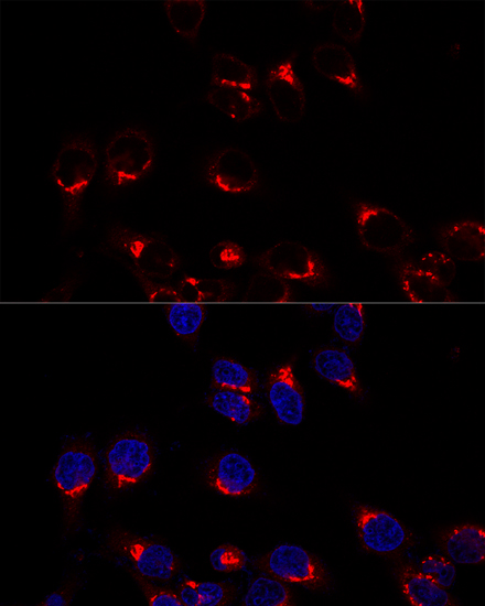 Confocal immunofluorescence analysis of Hela cells using USO1 Polyclonal Antibody at dilution of  1:200. Blue: DAPI for nuclear staining.