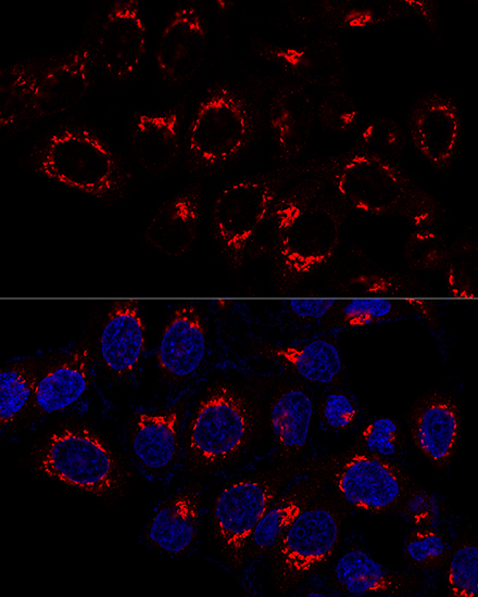 Confocal immunofluorescence analysis of HeLa cells using USO1 Polyclonal Antibody at dilution of  1:50. Blue: DAPI for nuclear staining.