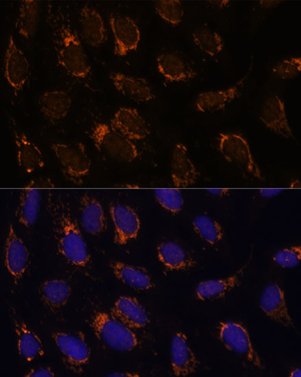 Immunofluorescence analysis of U-2 OS cells using TSFM Polyclonal Antibody at dilution of  1:100 (40x lens). Blue: DAPI for nuclear staining.