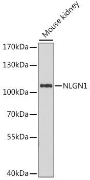 Western blot analysis of extracts of Mouse kidney using NLGN1 Polyclonal Antibody at dilution of 1:1000.