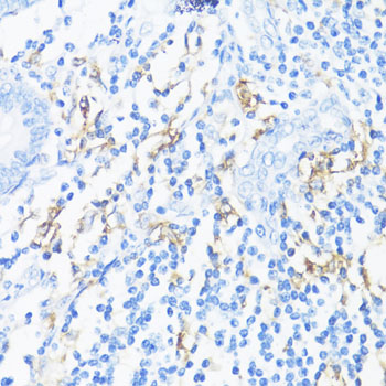 Immunohistochemistry of paraffin-embedded Human appendix using HLA-DRB3 Polyclonal Antibody at dilution of  1:100 (40x lens).