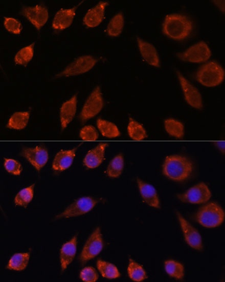 Immunofluorescence analysis of L929 cells using HPS4 Polyclonal Antibody at dilution of  1:100. Blue: DAPI for nuclear staining.