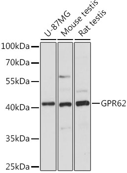Western blot analysis of extracts of various cell lines using GPR62 Polyclonal Antibody at dilution of 1:1000.