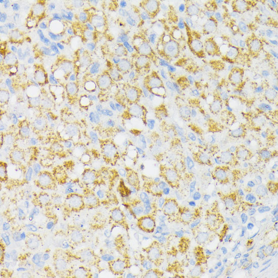 Immunohistochemistry of paraffin-embedded Rat ovary using USP33 Polyclonal Antibody at dilution of  1:100 (40x lens).