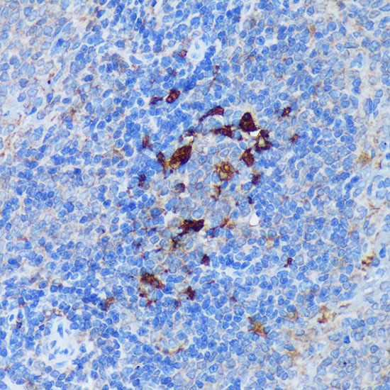 Immunohistochemistry of paraffin-embedded Rat spleen using PADI4 Polyclonal Antibody at dilution of  1:100 (40x lens).