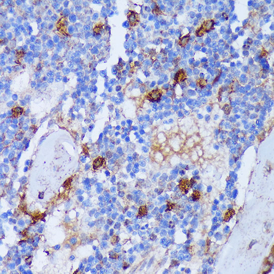 Immunohistochemistry of paraffin-embedded Rat bone marrow using PADI4 Polyclonal Antibody at dilution of  1:100 (40x lens).