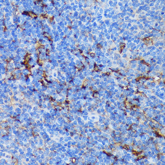 Immunohistochemistry of paraffin-embedded Mouse spleen using PADI4 Polyclonal Antibody at dilution of  1:100 (40x lens).