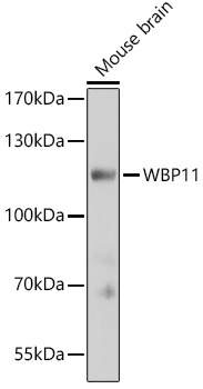 Western blot analysis of extracts of Mouse brain using WBP11 Polyclonal Antibody at dilution of 1:3000.