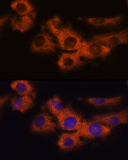 Immunofluorescence analysis of C6 cells using NDRG4 Polyclonal Antibody at dilution of  1:100. Blue: DAPI for nuclear staining.