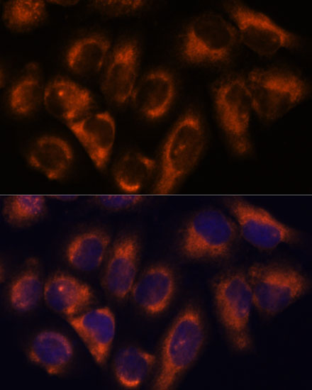 Immunofluorescence analysis of HeLa cells using NDRG4 Polyclonal Antibody at dilution of  1:100. Blue: DAPI for nuclear staining.