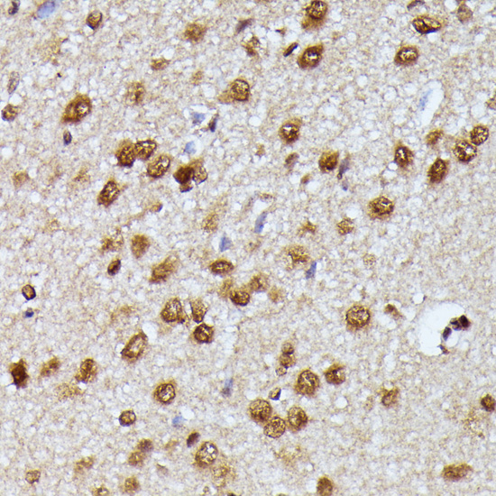 Immunohistochemistry of paraffin-embedded Rat brain using KIAA1429 Polyclonal Antibody at dilution of  1:100 (40x lens).