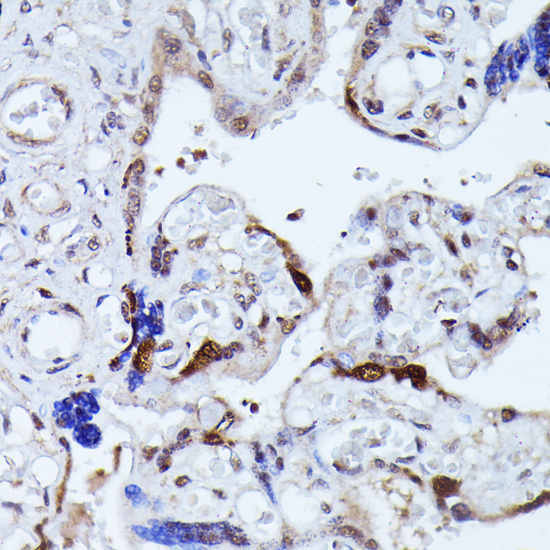 Immunohistochemistry of paraffin-embedded Human placenta using KIAA1429 Polyclonal Antibody at dilution of  1:100 (40x lens).