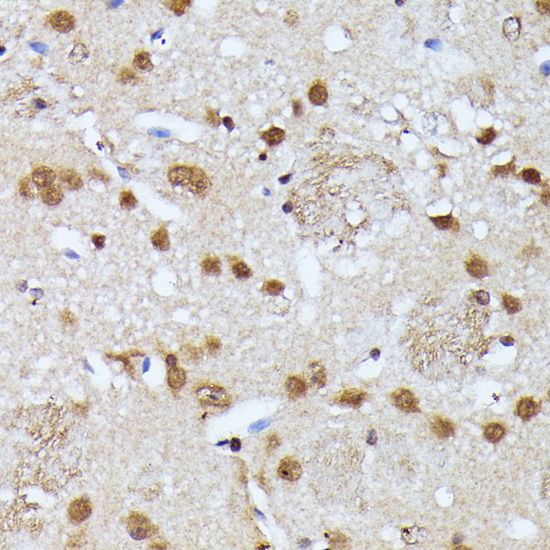 Immunohistochemistry of paraffin-embedded Mouse brain using KIAA1429 Polyclonal Antibody at dilution of  1:100 (40x lens).