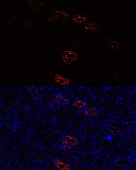 Immunofluorescence analysis of Rat kidney cells using AQP2 Polyclonal Antibody at dilution of  1:100. Blue: DAPI for nuclear staining.