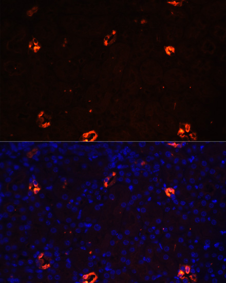 Immunofluorescence analysis of Mouse kidney cells using AQP2 Polyclonal Antibody at dilution of  1:100. Blue: DAPI for nuclear staining.