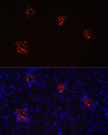 Immunofluorescence analysis of Rat kidney cells using AQP2 Polyclonal Antibody at dilution of  1:100. Blue: DAPI for nuclear staining.