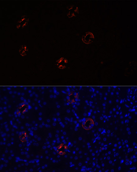 Immunofluorescence analysis of Rat kidney cells using AQP2 Polyclonal Antibody at dilution of  1:100. Blue: DAPI for nuclear staining.