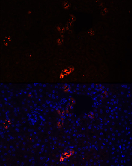 Immunofluorescence analysis of Mouse kidney cells using AQP2 Polyclonal Antibody at dilution of  1:100. Blue: DAPI for nuclear staining.