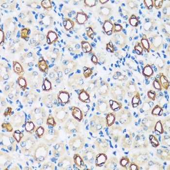 Immunohistochemistry of paraffin-embedded Mouse kidney using AQP2 Polyclonal Antibody at dilution of  1:100 (40x lens).