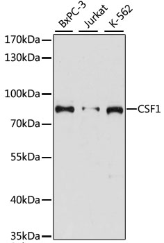 Western blot analysis of extracts of various cell lines using CSF1 Polyclonal Antibody at dilution of 1:3000.