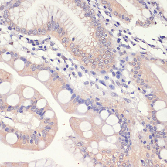 Immunohistochemistry of paraffin-embedded Human small intestine using HMGCR Polyclonal Antibody at dilution of  1:200 (40x lens).